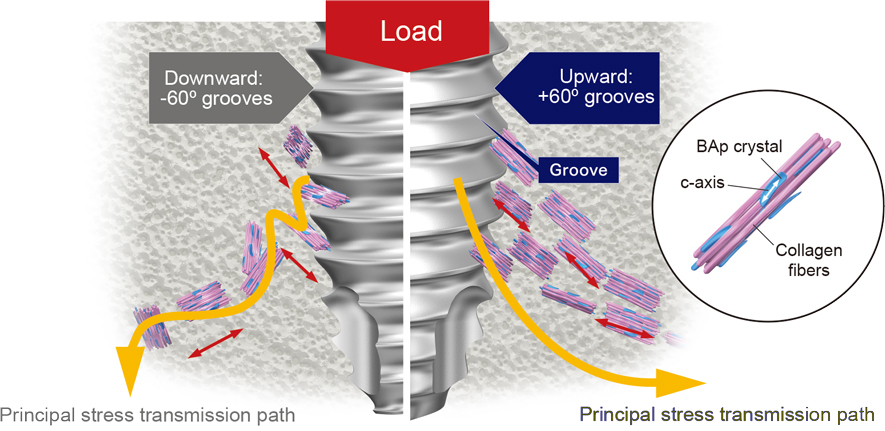 Dental Implant Basics: Soft Tissue Manipulation by Alani & Corson