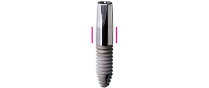 Subgingival design