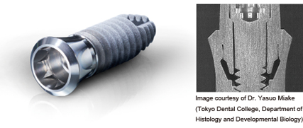 Tapered OCTA Connection (8.0º per side)